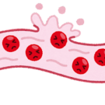赤血球の寿命は120日間。出血・溶血は赤血球が失われるため貧血の原因となる。網赤血球は増加する。