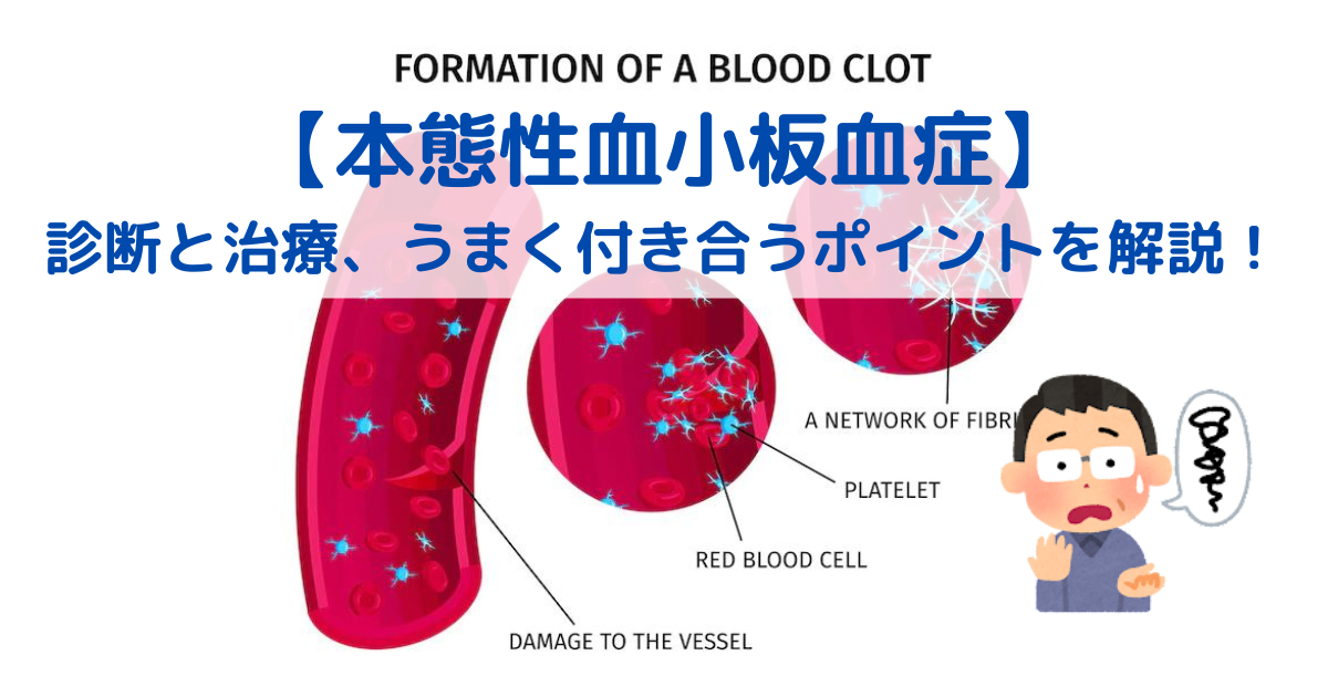 薬剤性血小板減少症の治療と展望